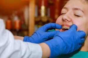 Orthodontiste plaçant un disjoncteur palatin dans la bouche d’un jeune patient.